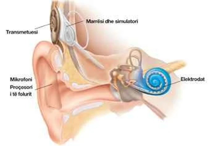 25 SHKURTI-DITA NDËRKOMBËTARE E IMPLANTIT KOKLEAR!